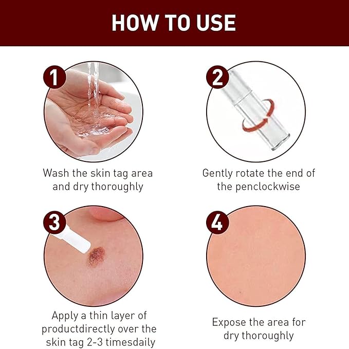 Tags and Mole Remover